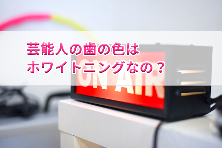 芸能人の歯の色はホワイトニングなの?
